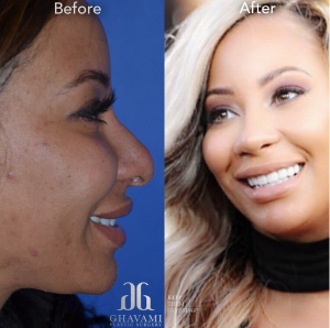 Dr Ashkan Ghavami premier Plastic Surgeon to the Stars